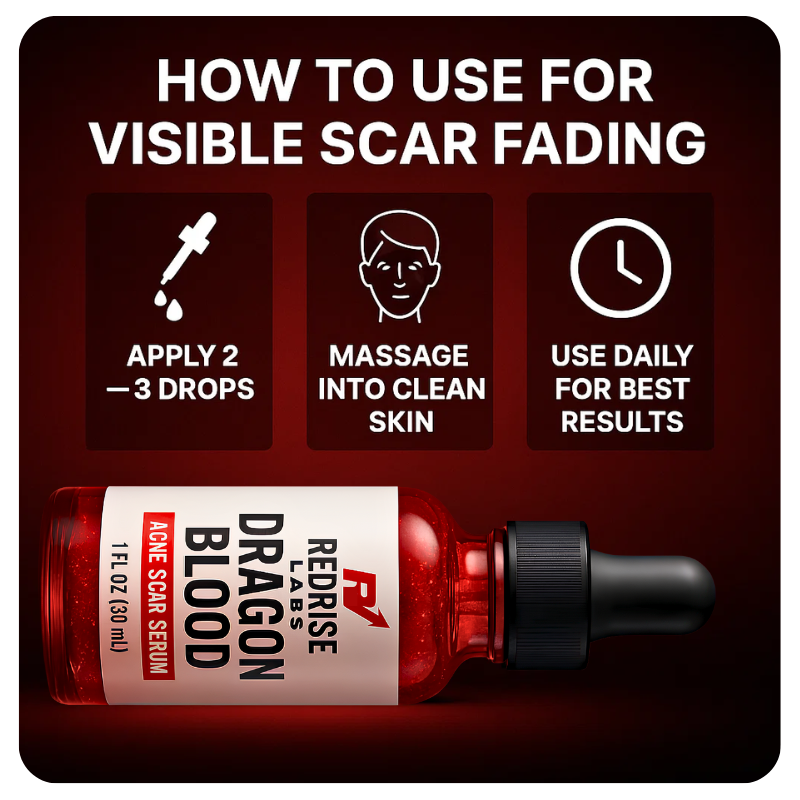 Dragon Blood Acne Scar Serum